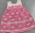 Picture of baby frock