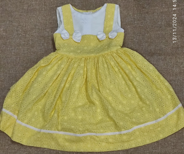 Picture of baby frock