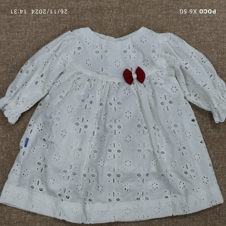 Picture of baby frock