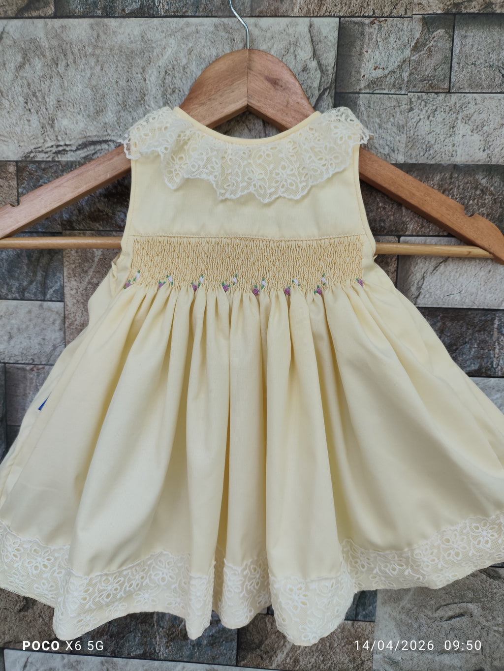 Picture of baby frock