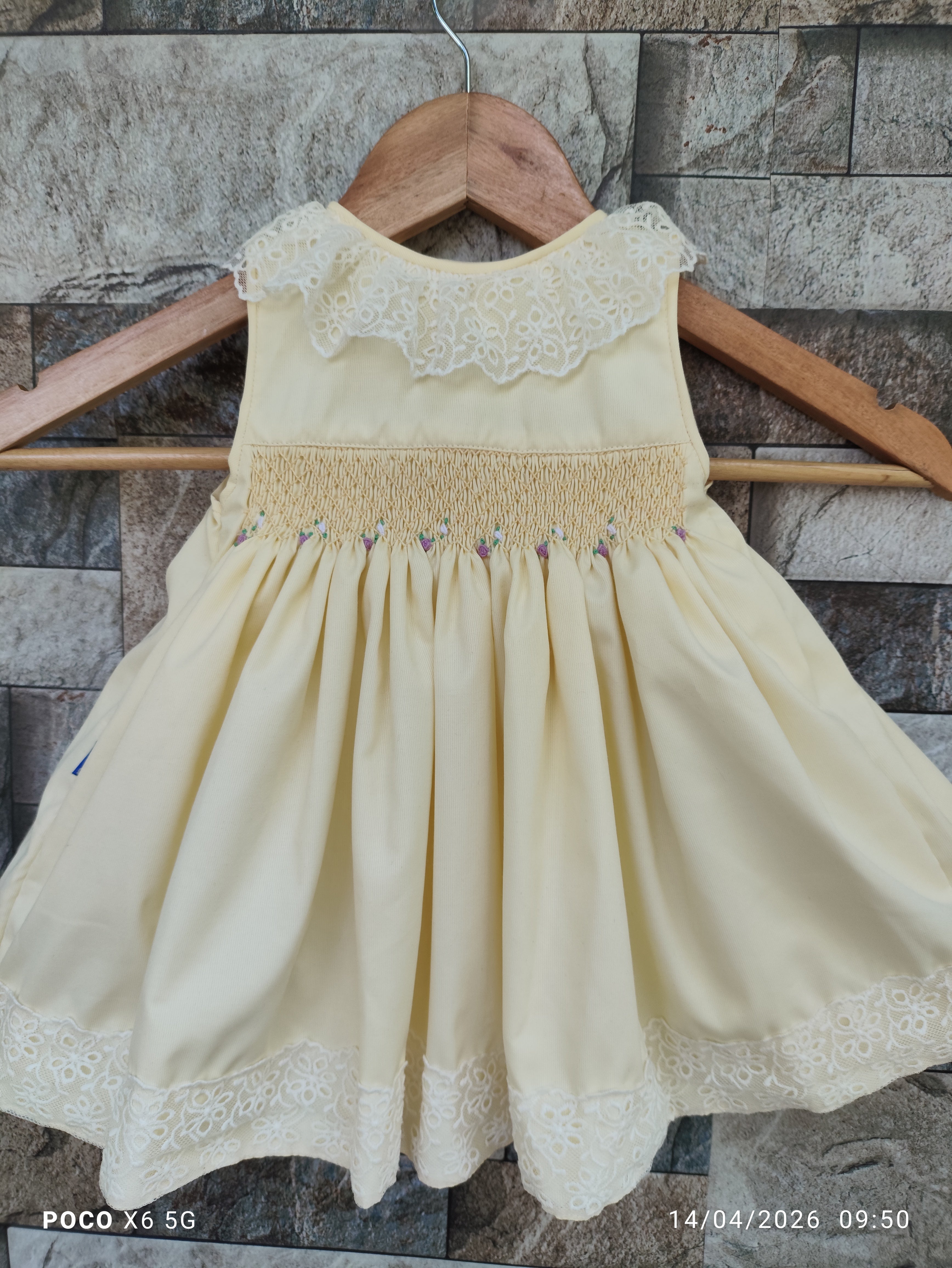 Picture of baby frock