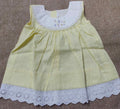 Picture of baby frock
