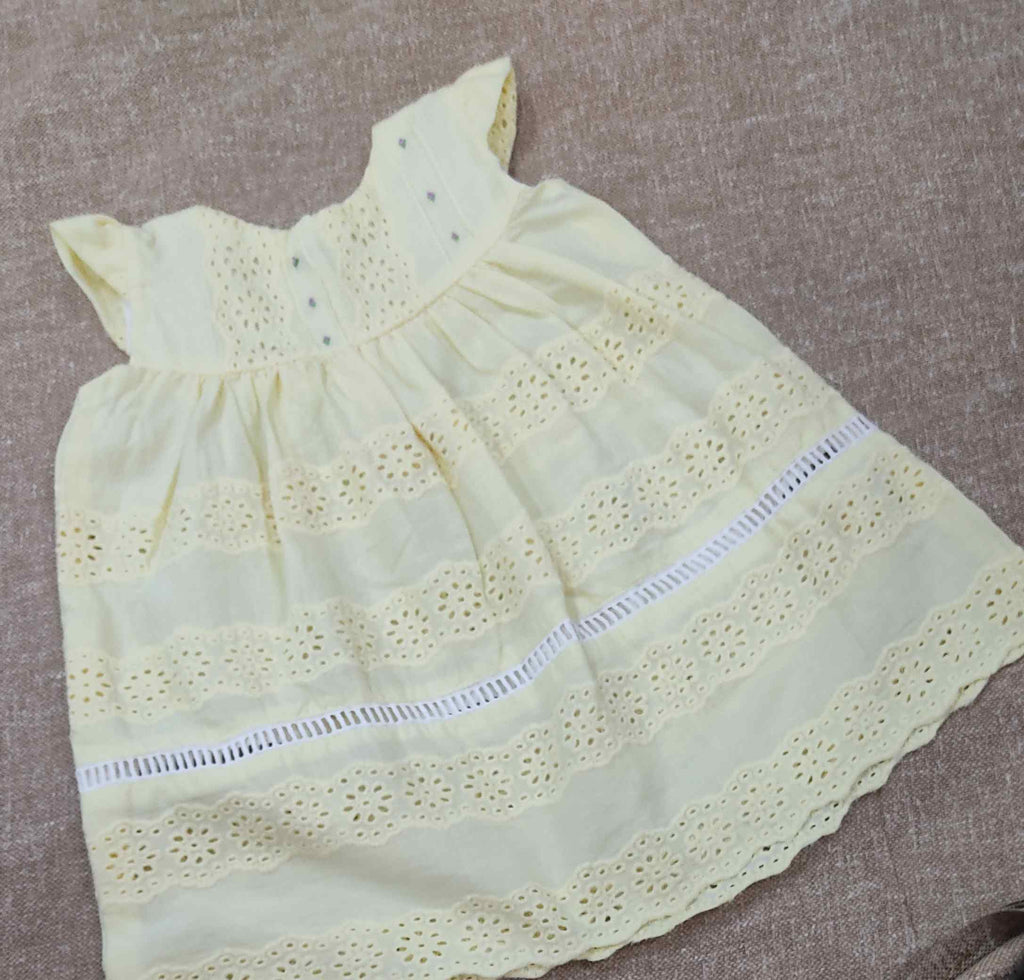 Picture of baby frock